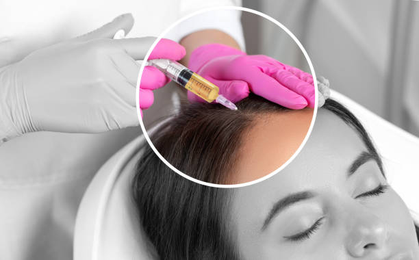 PRP Treatment